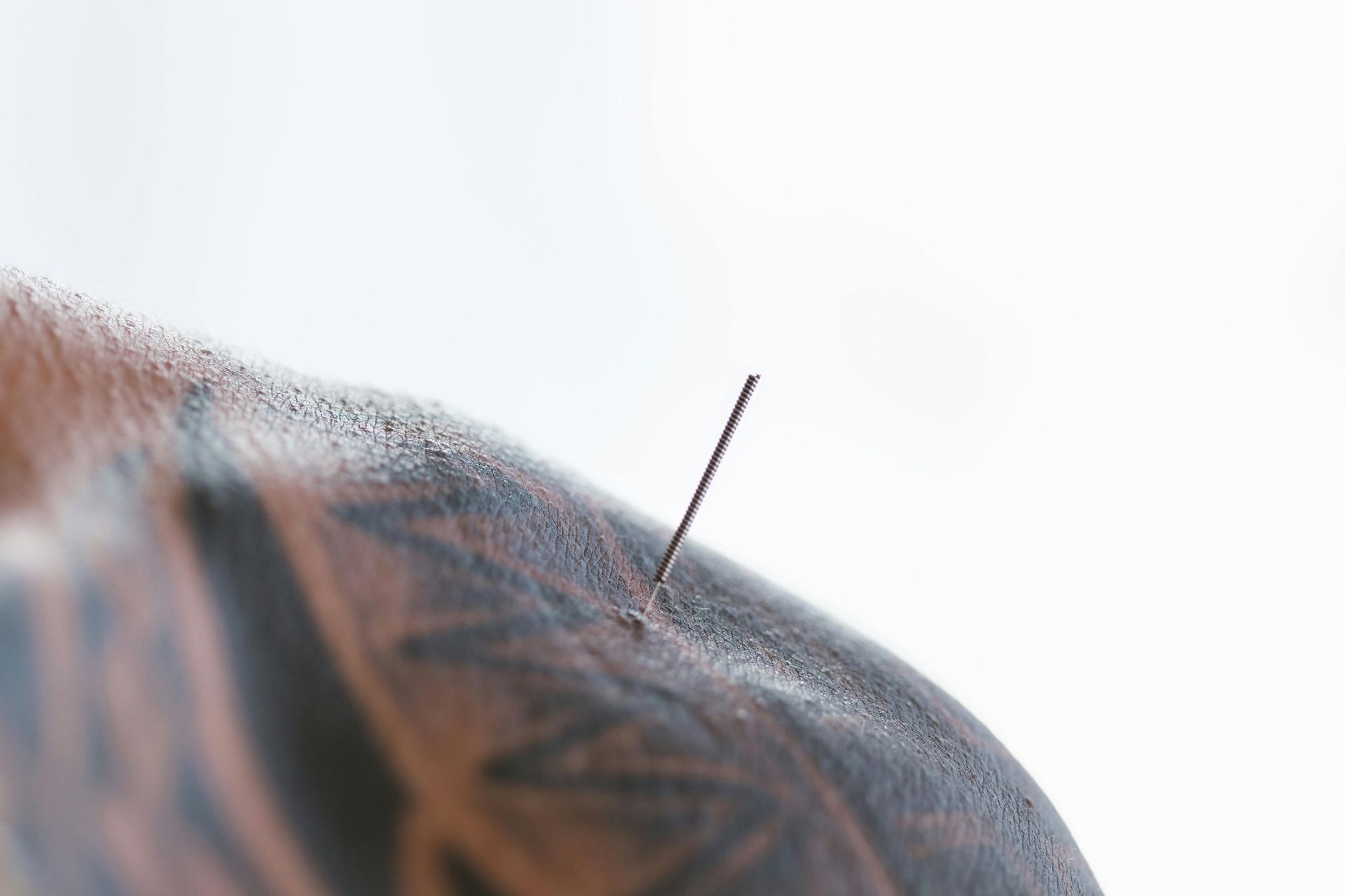 Main insérant une aiguille d'acupuncture dans la peau d'une personne.