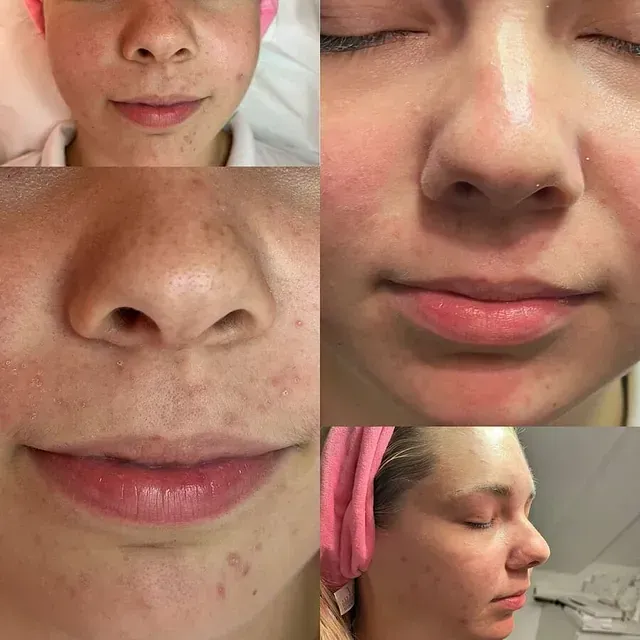 Un primer plano del rostro de una mujer con los ojos cerrados.