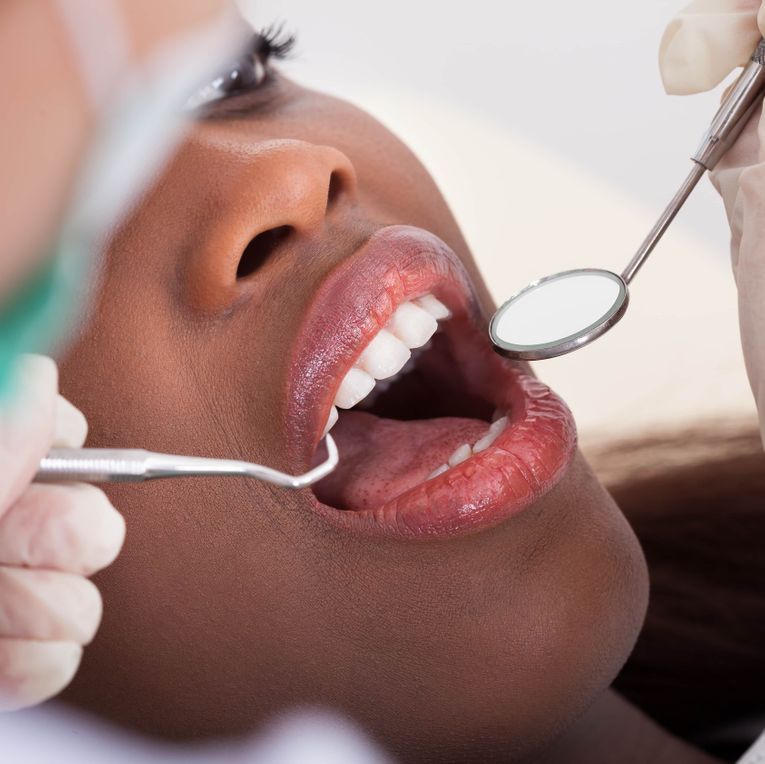 détartrage - Annie-Claude Gagnon hygiéniste indépendante