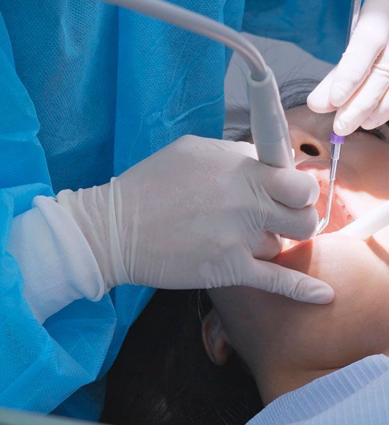 Una mujer se está haciendo examinar los dientes por un dentista.