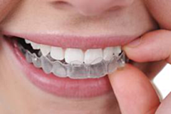Una persona se está colocando un retenedor transparente en los dientes.
