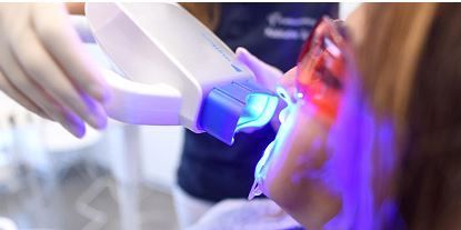 Λεύκανση Δοντιών