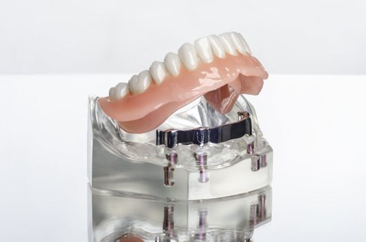 Zahnprothese - Zahnprothetik Elmiger