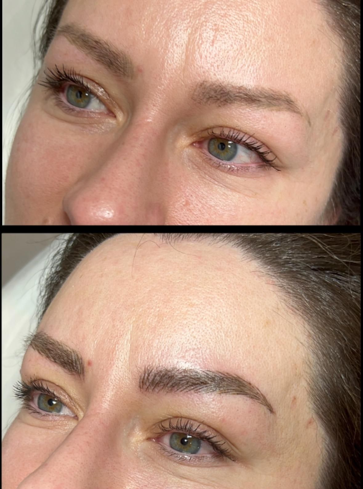 Primer plano de las cejas de una persona, antes y después, donde la ceja inferior se ve más poblada y definida.