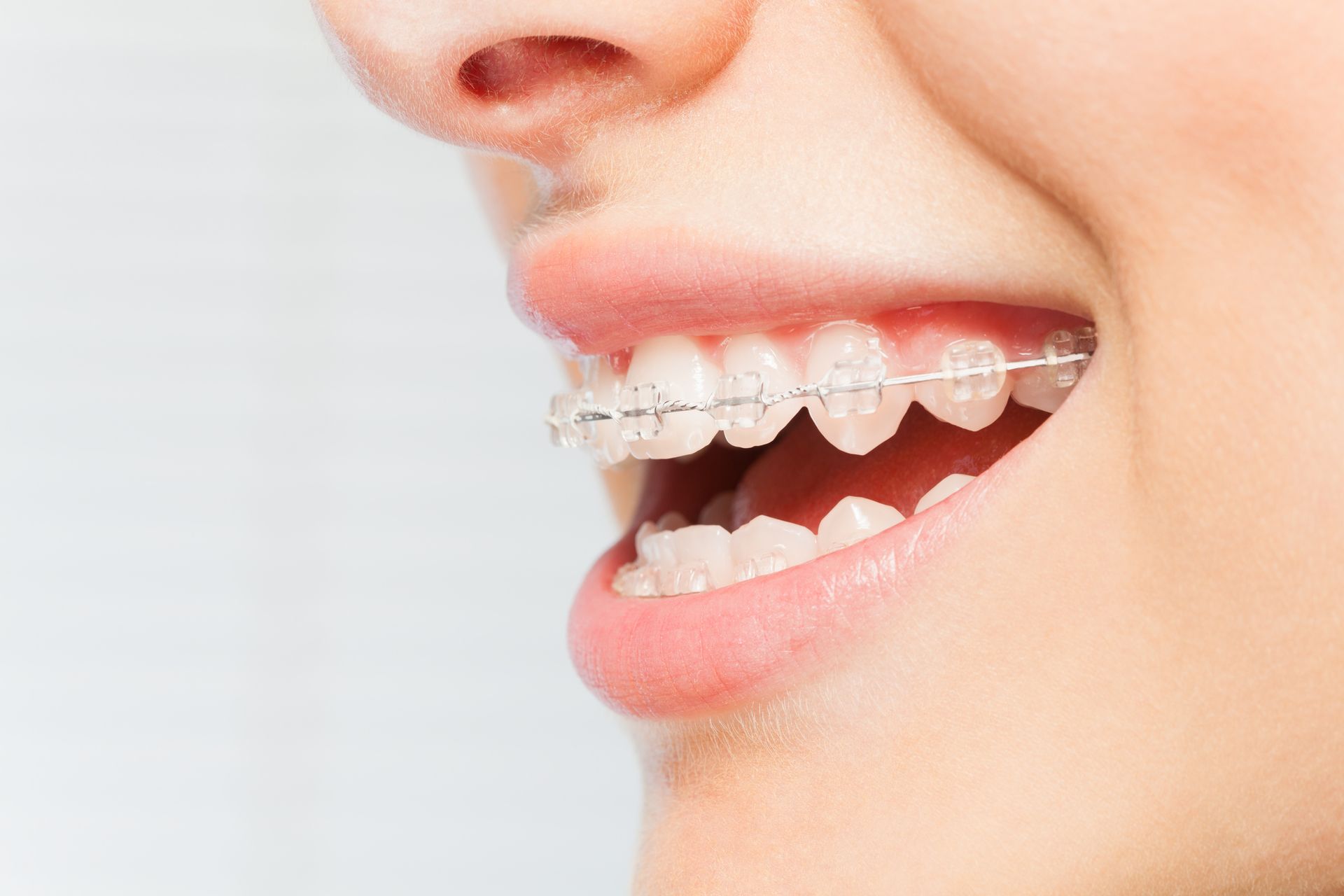 Mulher no dentista com a boca aberta, mãos enluvadas de azul segurando instrumentos odontológicos.