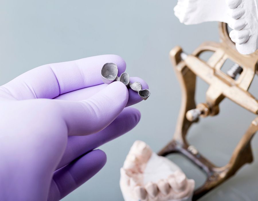 Una persona que lleva guantes morados sostiene una corona dental en su mano.