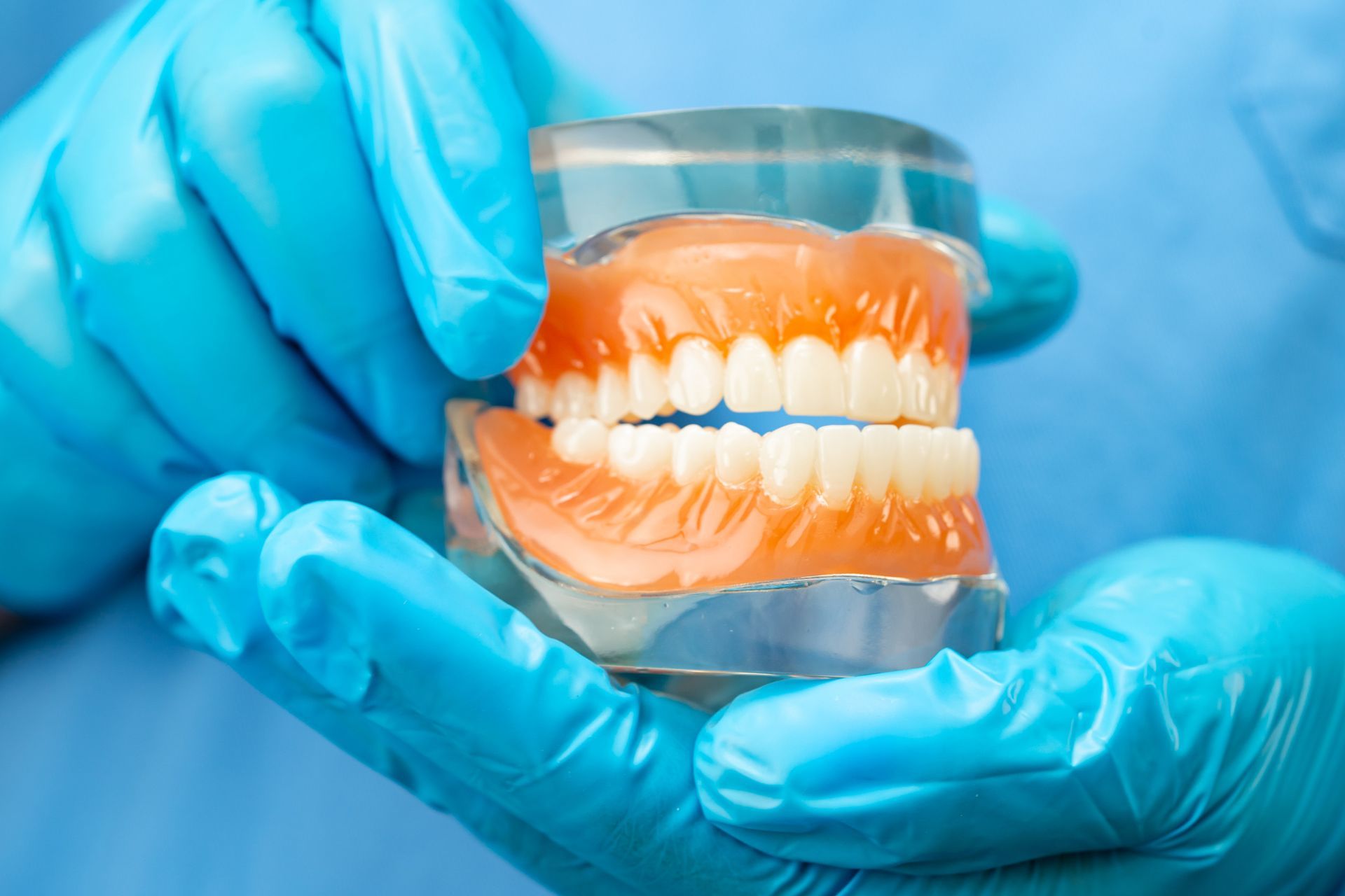 Manos con guantes azules sosteniendo una dentadura postiza en un modelo de plástico transparente.