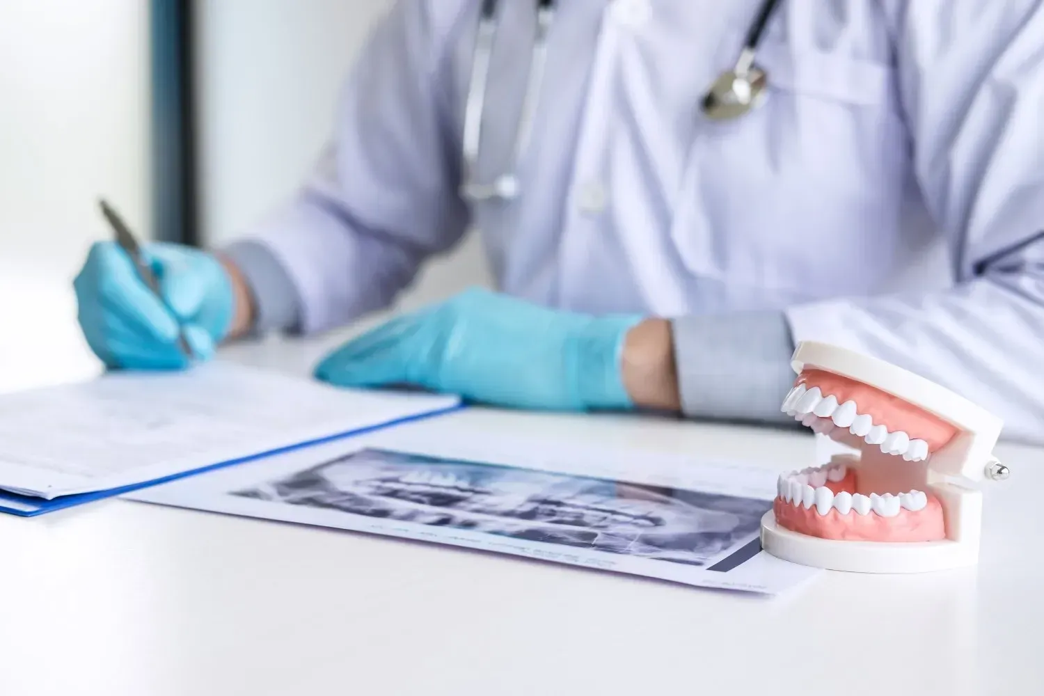 Un profesional dental, con guantes azules y bata blanca, escribe en una ficha junto a una radiografía dental .