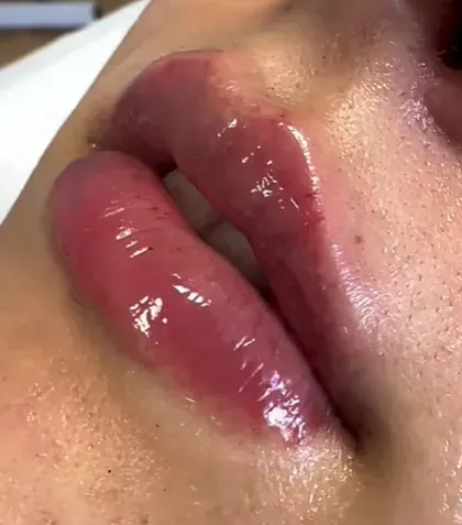 Un primer plano de los labios de una persona con mucho brillo en ellos.