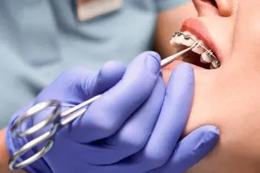 Hammastarkastus ja hammashoidot