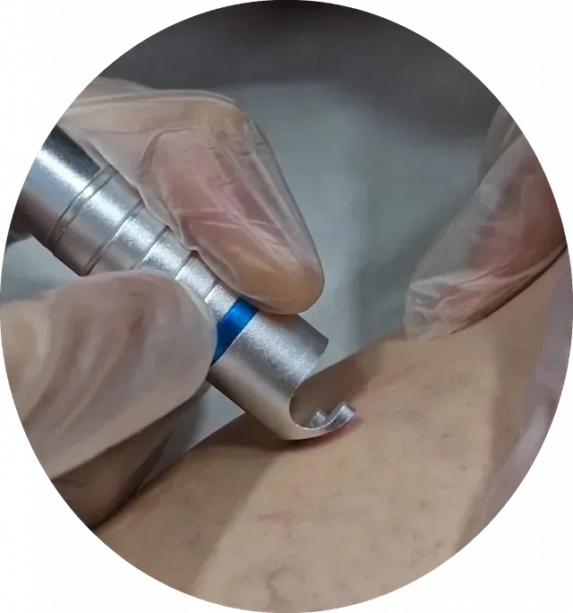 Una persona está usando una máquina en el brazo de otra persona.