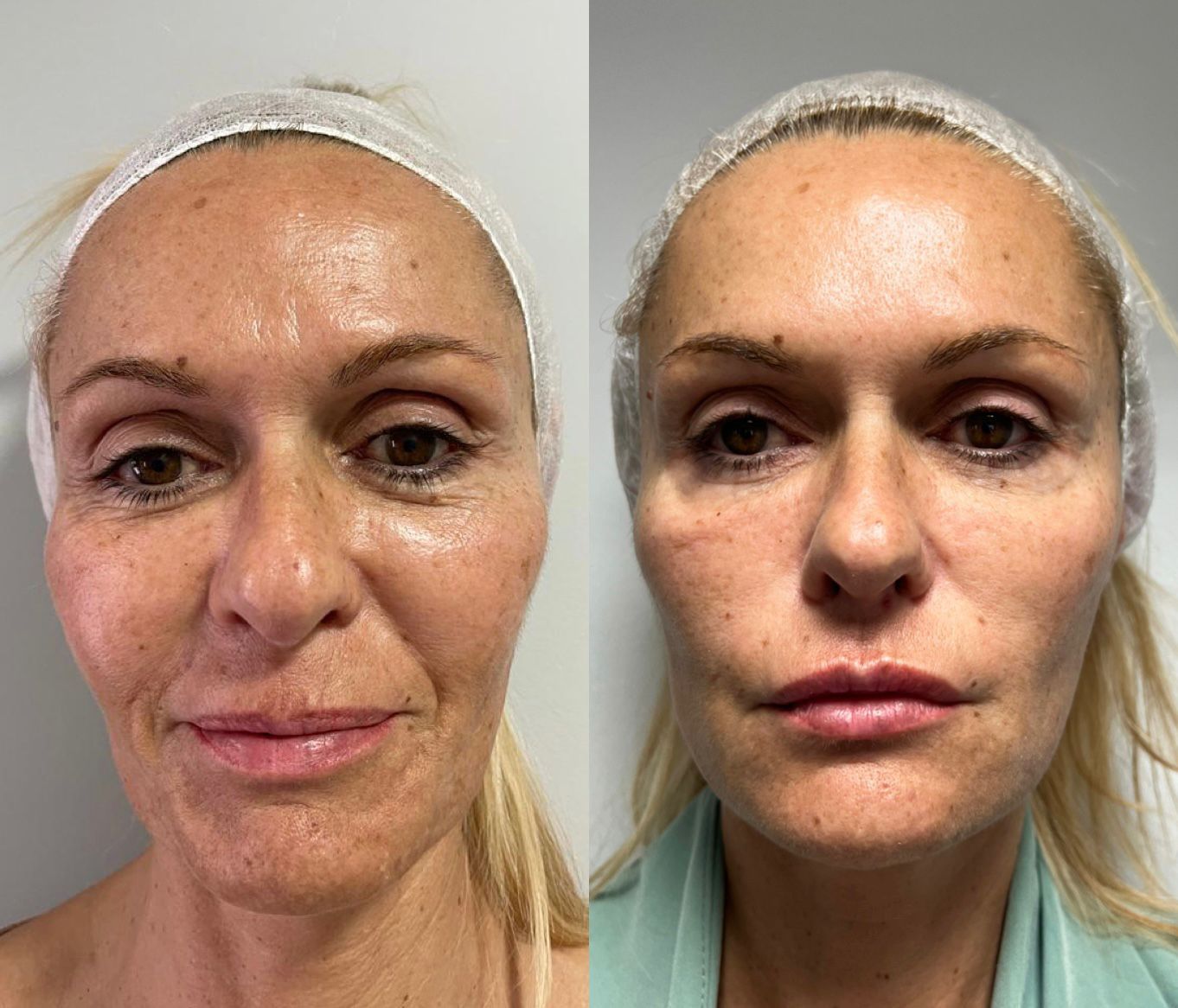 Dos fotografías del rostro de una mujer, una al lado de la otra, con ligeras diferencias de maquillaje y una expresión neutra.