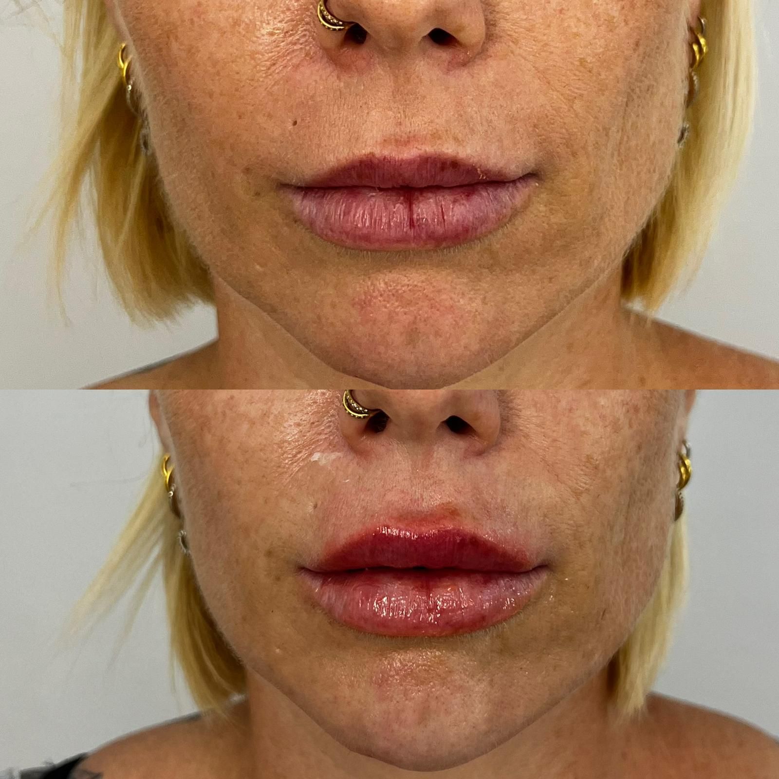 Primer plano de los labios antes y después de usar un piercing en la nariz; arriba, labios con un acabado natural; abajo, labios pintados con un labial rojo brillante.