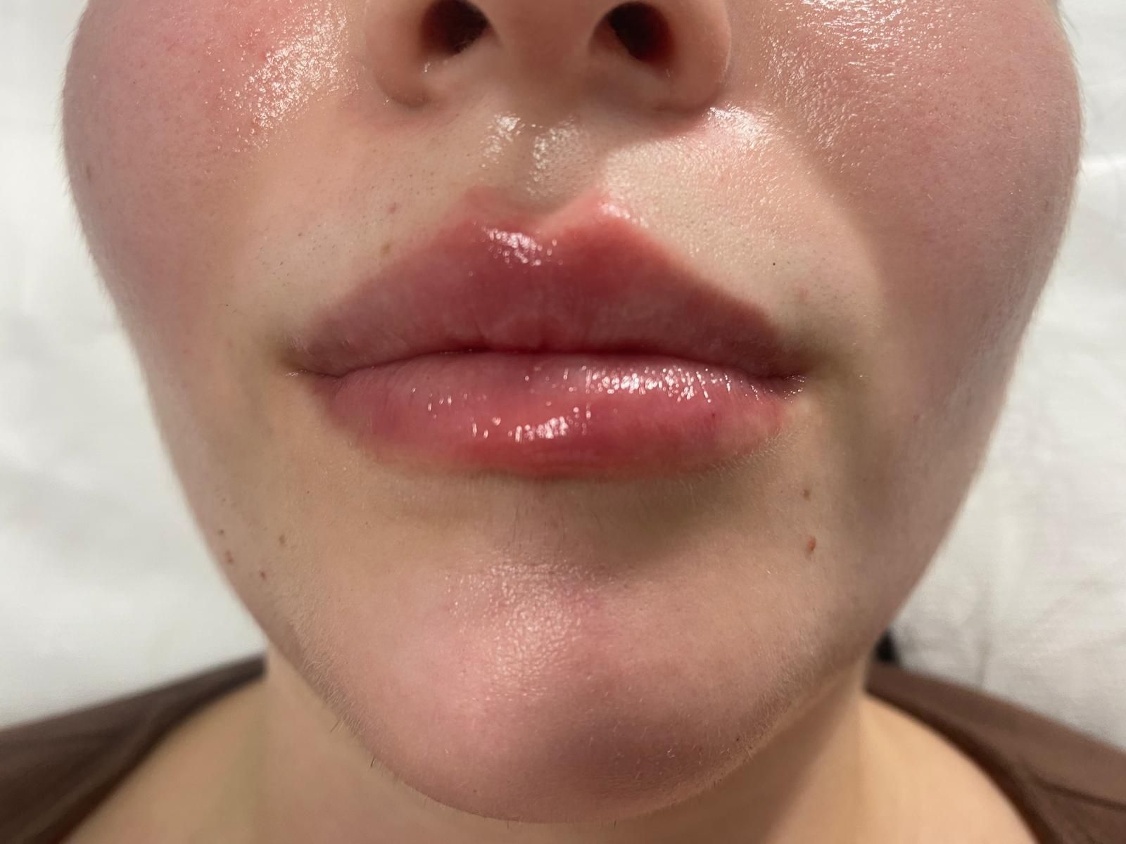 Primer plano de labios brillantes y parte inferior del rostro con textura de piel visible y un piercing en la nariz.