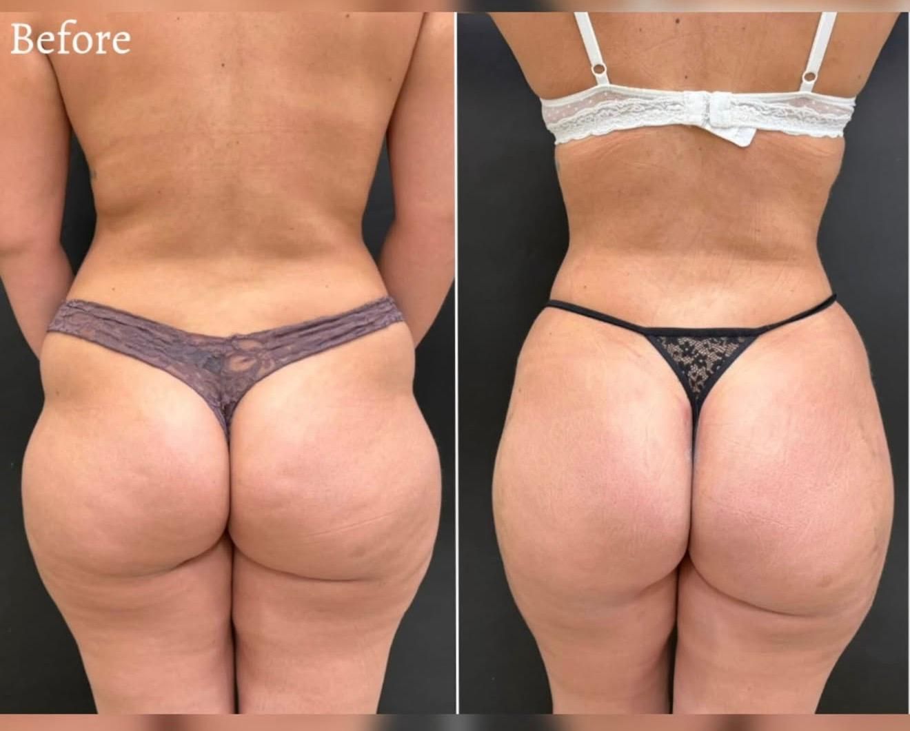 Comparación lado a lado de la vista posterior 