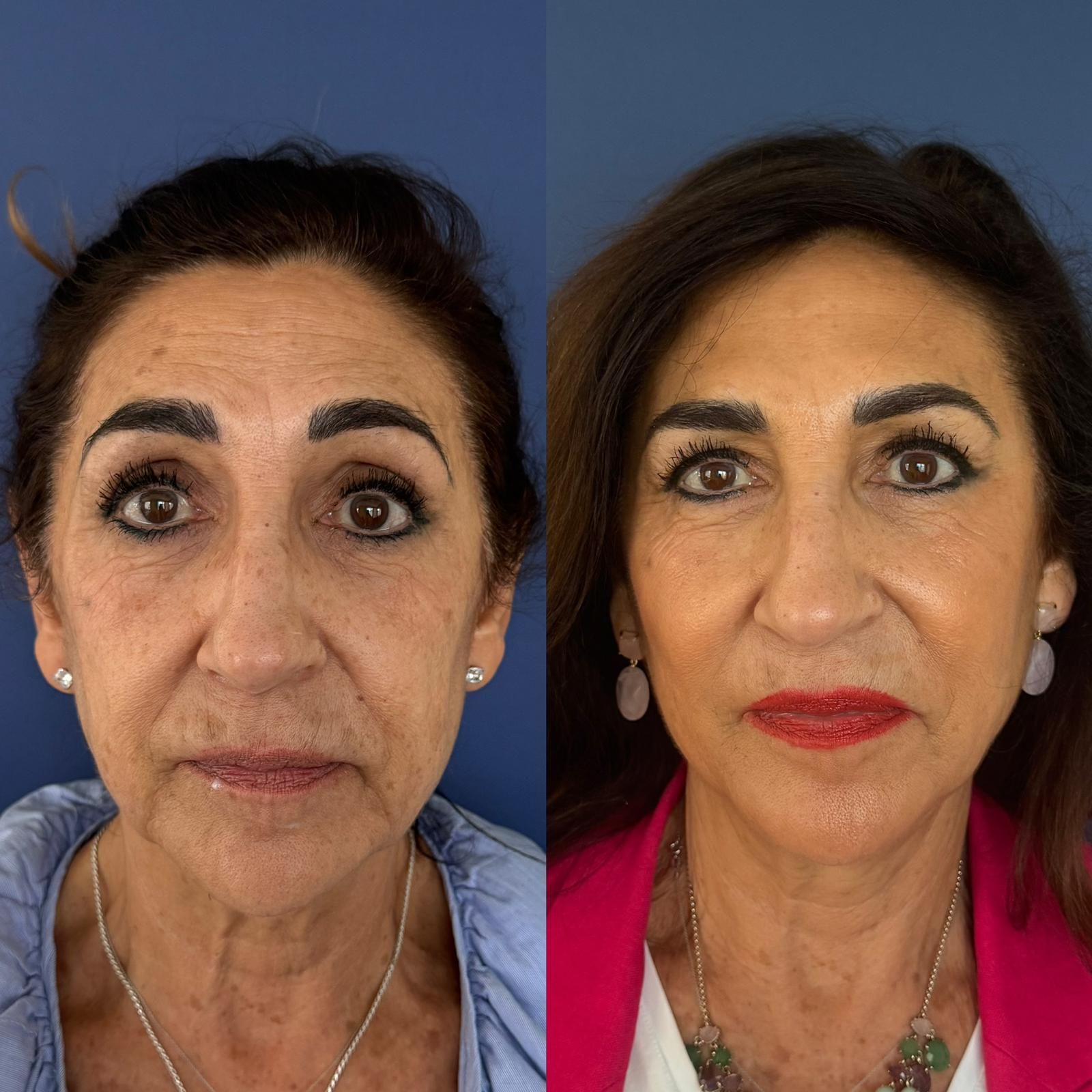 Retrato comparativo de una mujer antes y después del maquillaje, con un maquillaje más llamativo y lápiz labial rojo a la derecha.