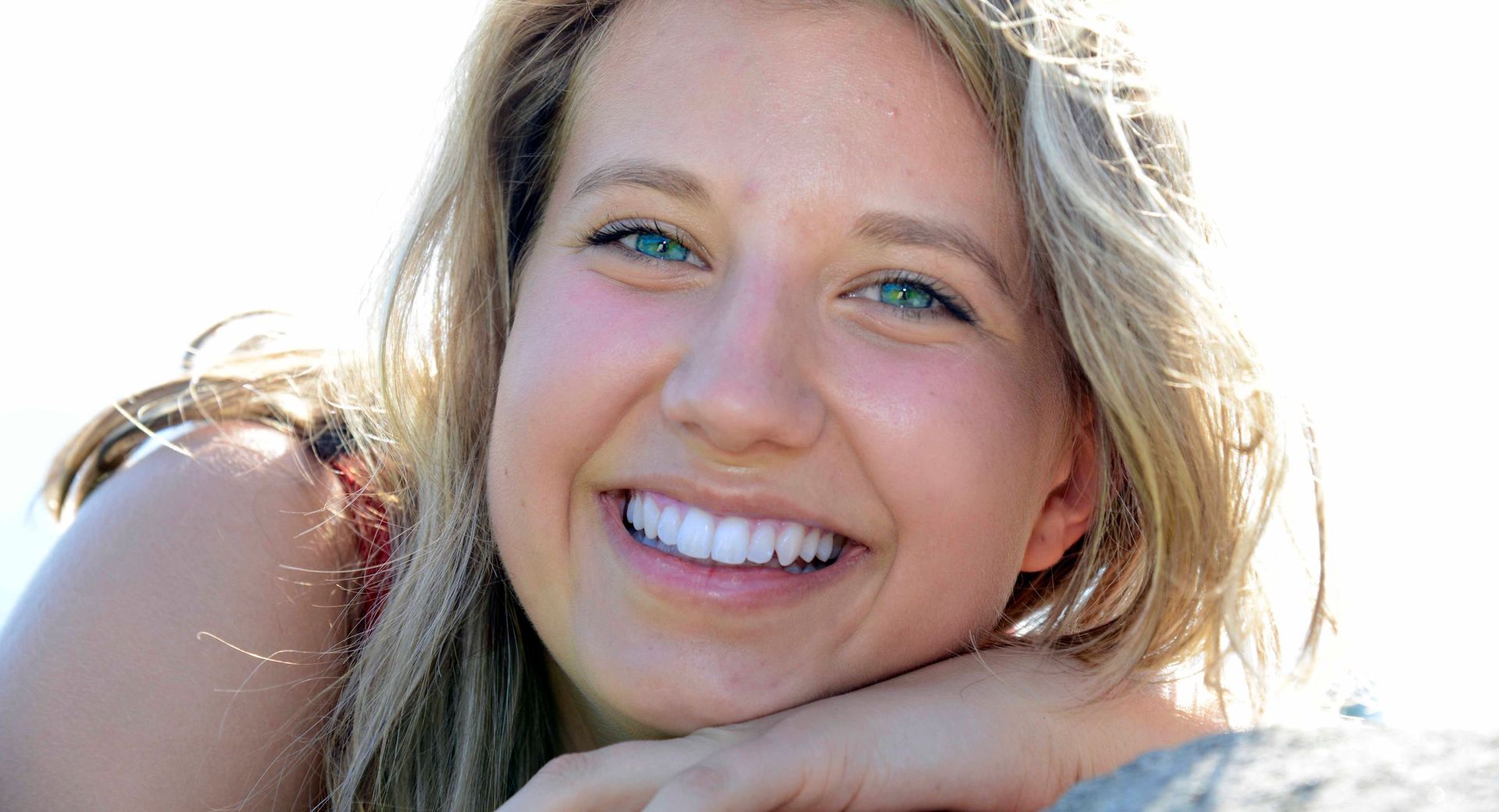 Denti bianchi e curati Laboratorio MCM Lugano