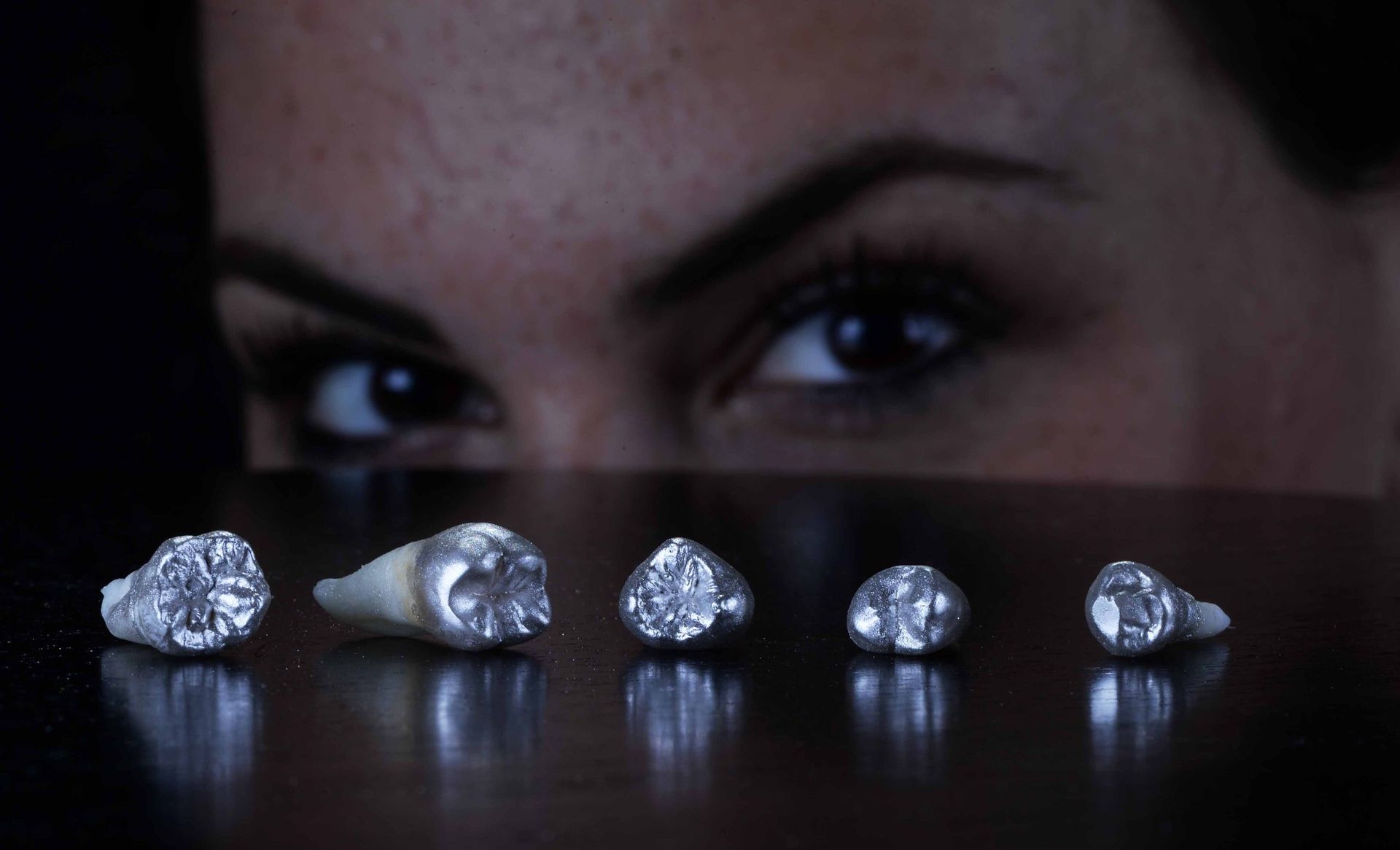 Denti in argento - Laboratorio MCM Lugano