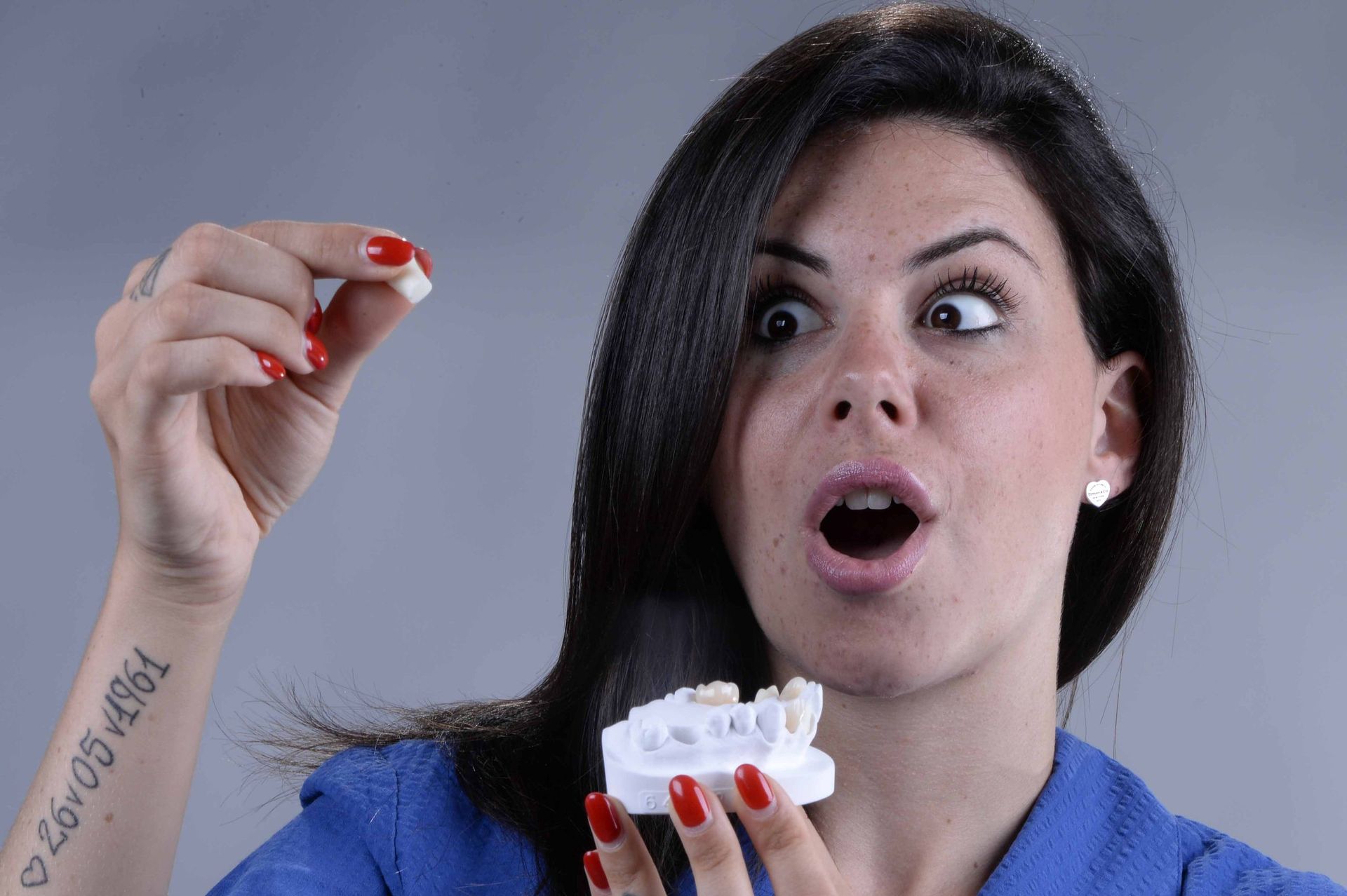 Estrazione dente - Laboratorio MCM Lugano