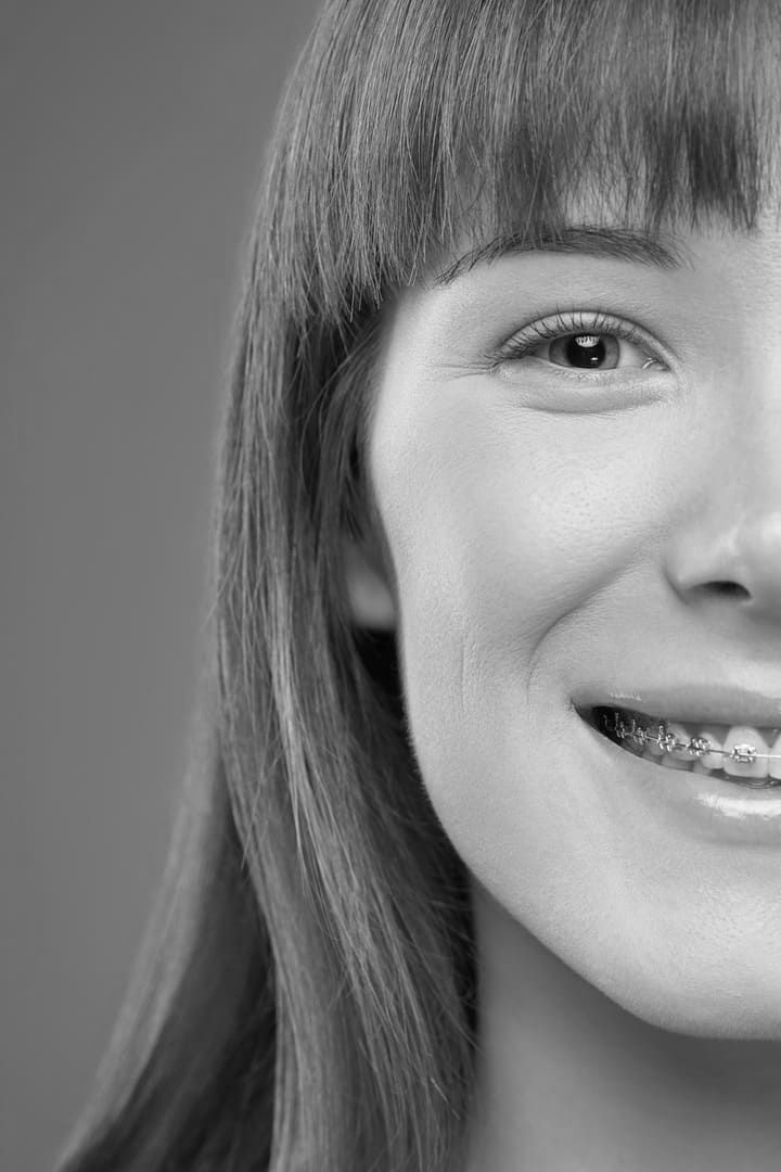 Una fotografía en blanco y negro de una mujer con aparatos dentales sonriendo.