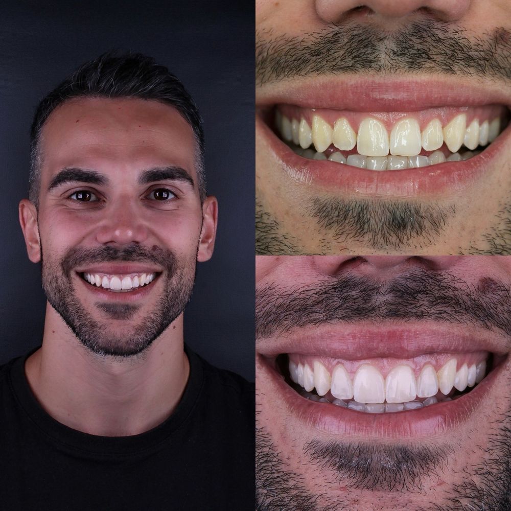 Un hombre con barba sonríe y muestra los dientes.