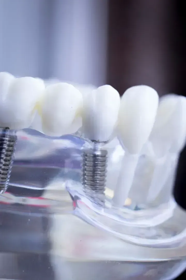 Una mujer está sentada en una silla dental sosteniendo una tabla de colores de dientes.