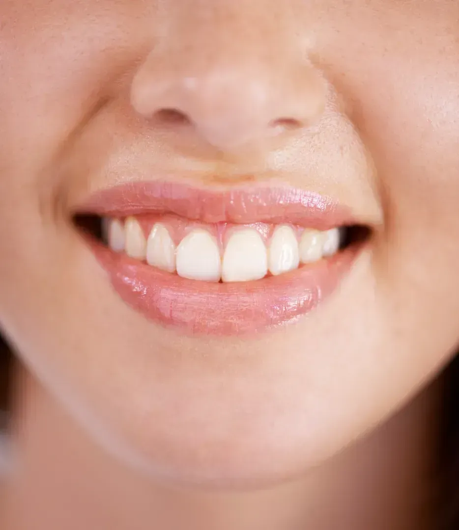 Un primer plano de la boca y los dientes de una mujer.