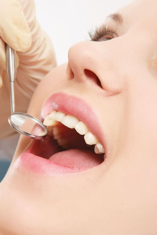 Una mujer se está haciendo examinar los dientes por un dentista.