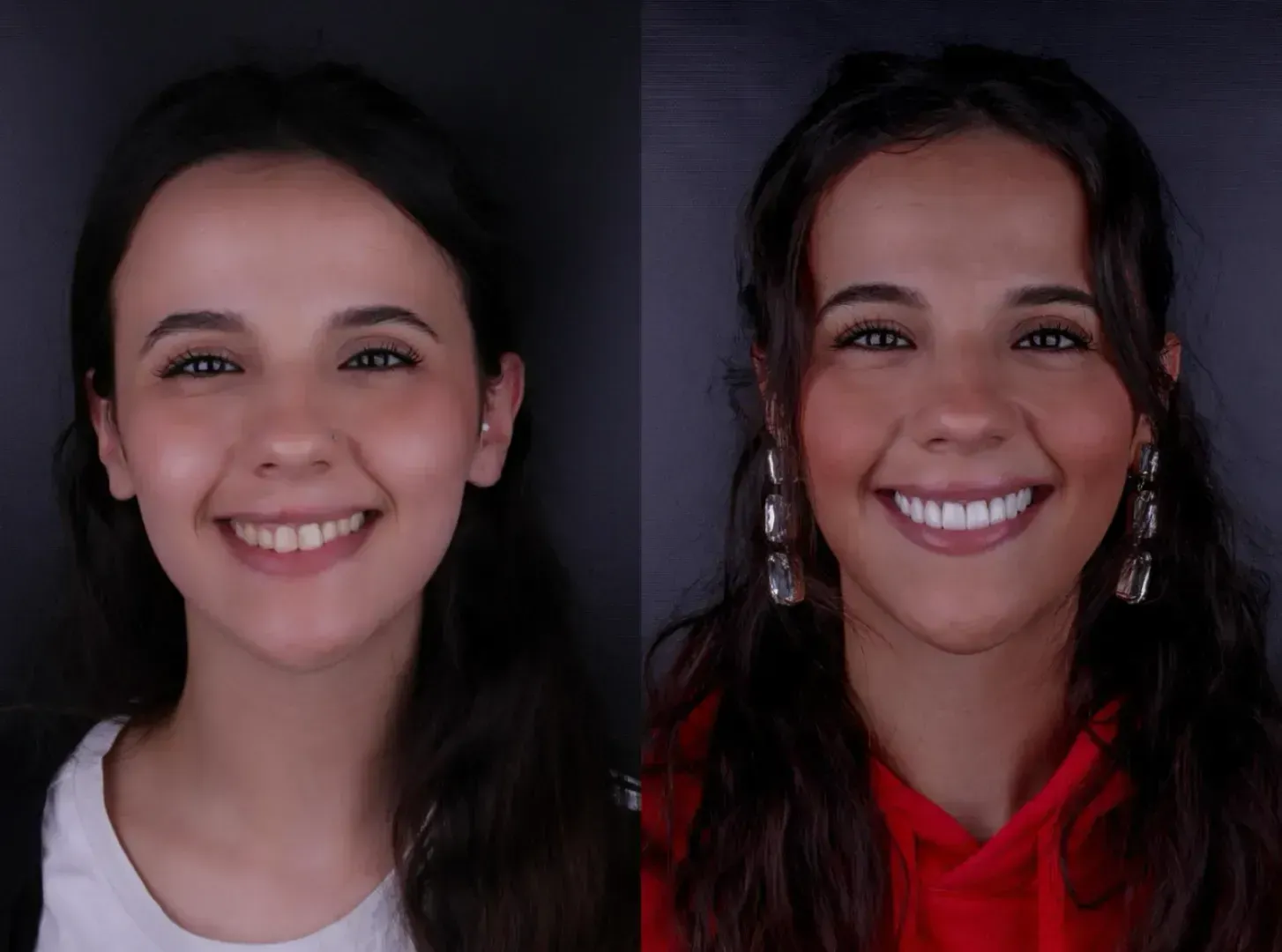 Una foto de antes y después de una mujer sonriendo.