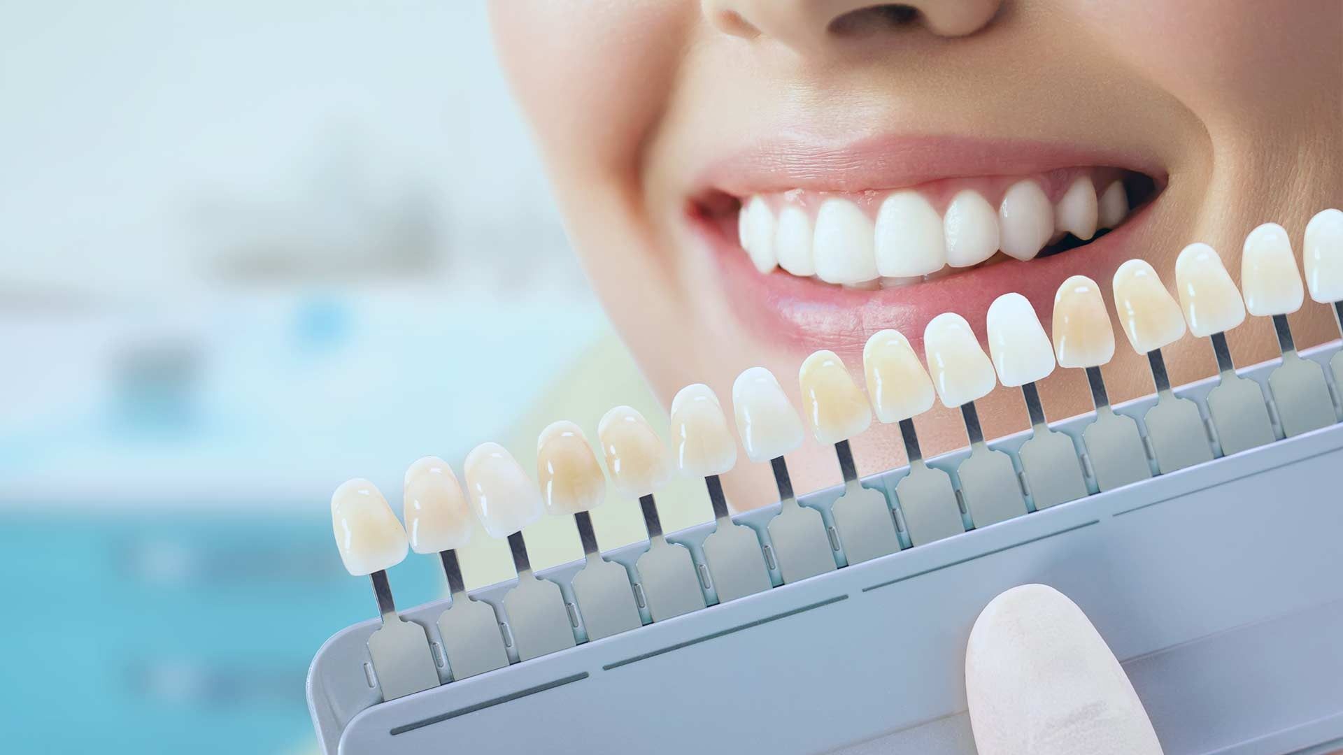 Una mujer sostiene una tabla de colores de dientes frente a sus dientes.