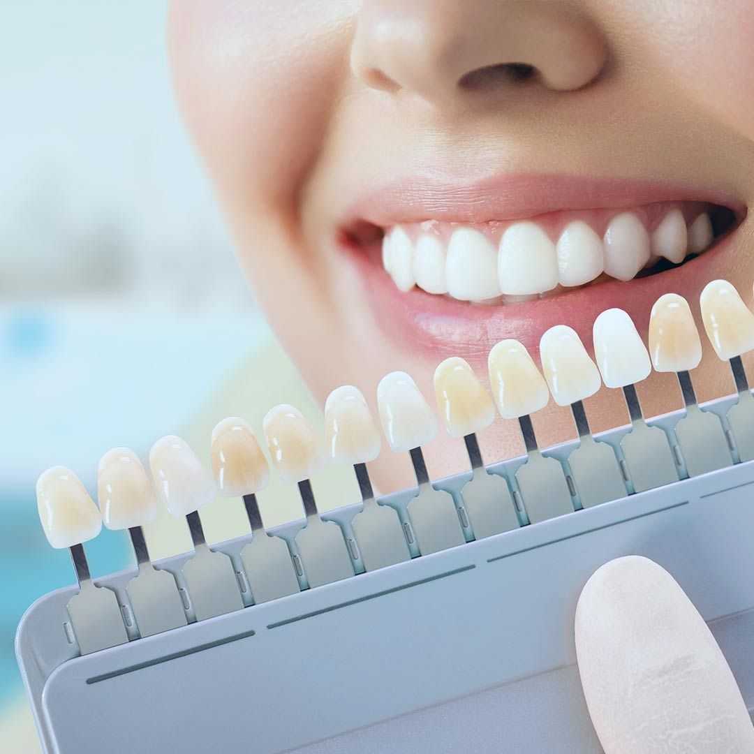 Una mujer sostiene una tabla de colores de dientes frente a su boca.