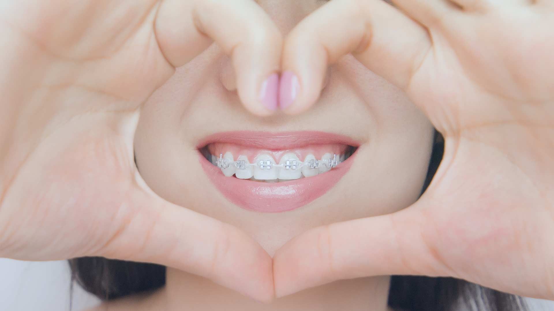 Una mujer con aparatos ortopédicos está haciendo forma de corazón con sus manos.