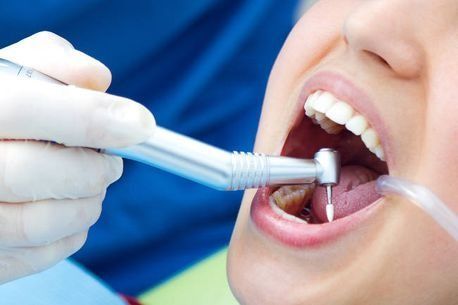 Una mujer está siendo examinada por un dentista.