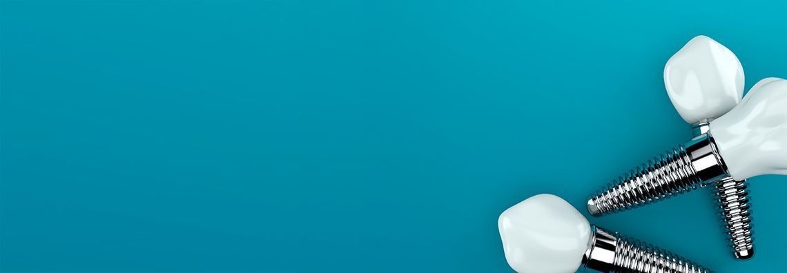 Un par de implantes dentales sobre un fondo azul.