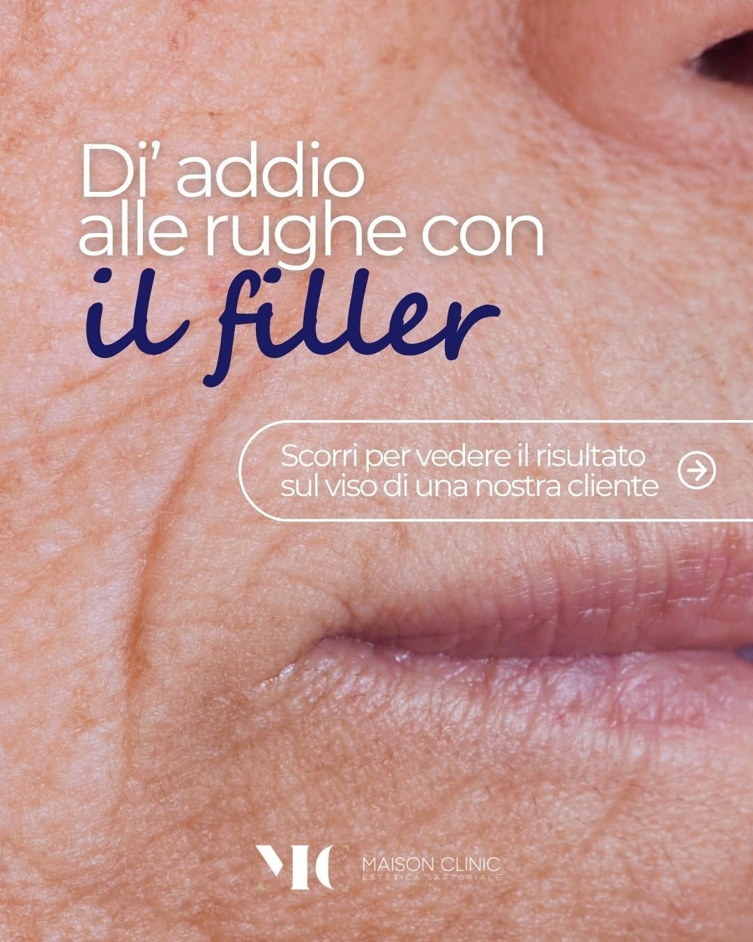 Un cerchio bianco, due forme grigie simili a montagne, il tutto su uno sfondo grigio chiaro.