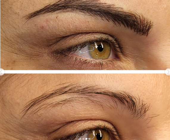 Una foto de antes y después de las cejas de una mujer.