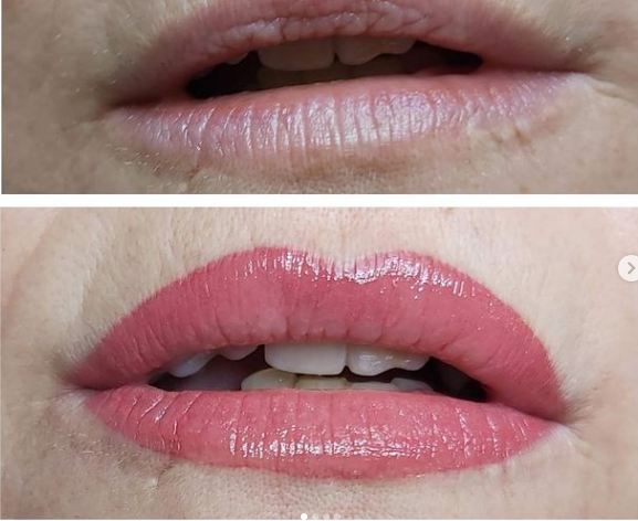Una fotografía de antes y después de los labios de una mujer con lápiz labial rosa.