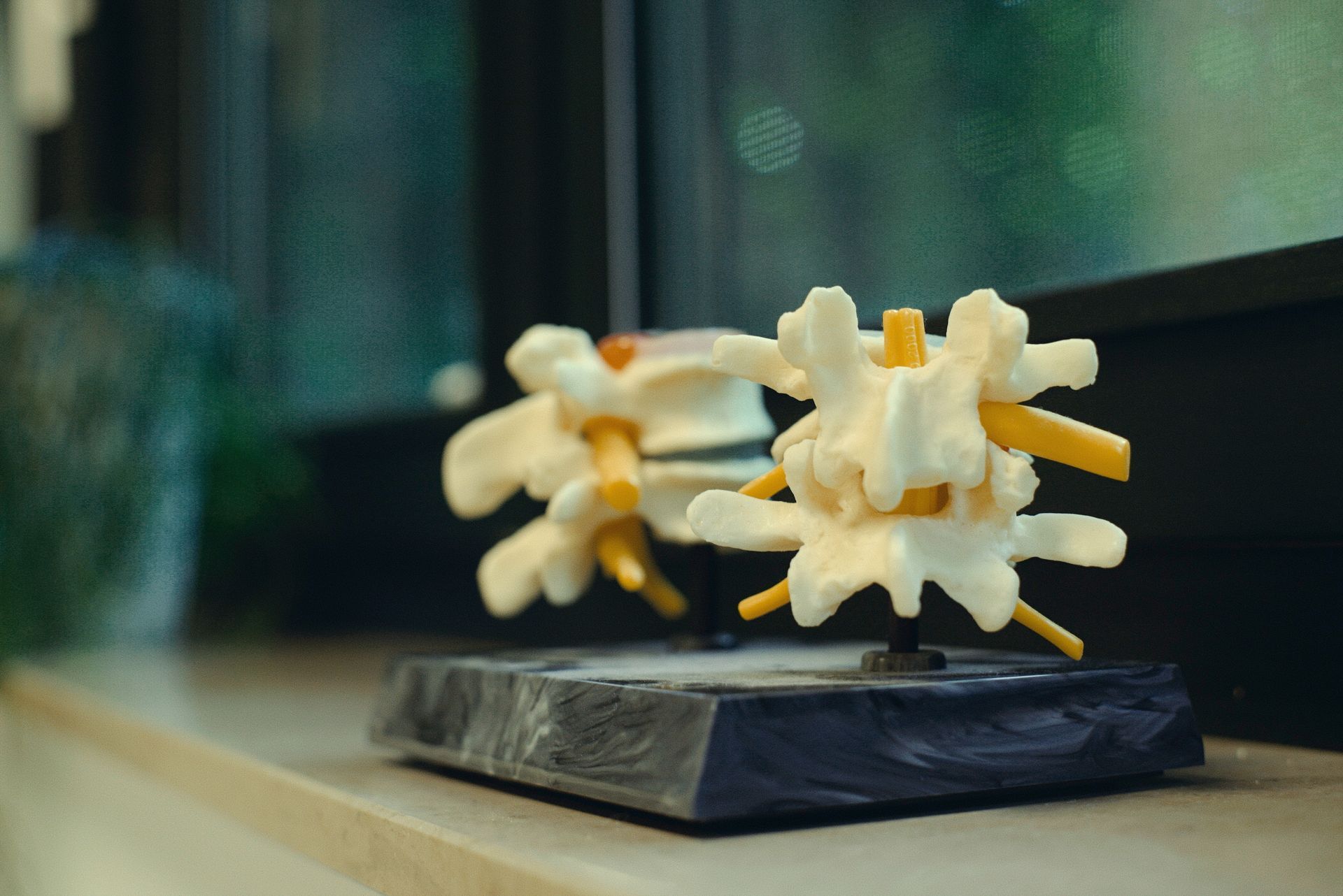 Auf einem Tisch steht ein Modell einer menschlichen Wirbelsäule.