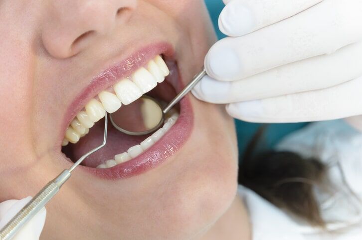 Dentista examinando os dentes de um paciente com espelho e sonda.