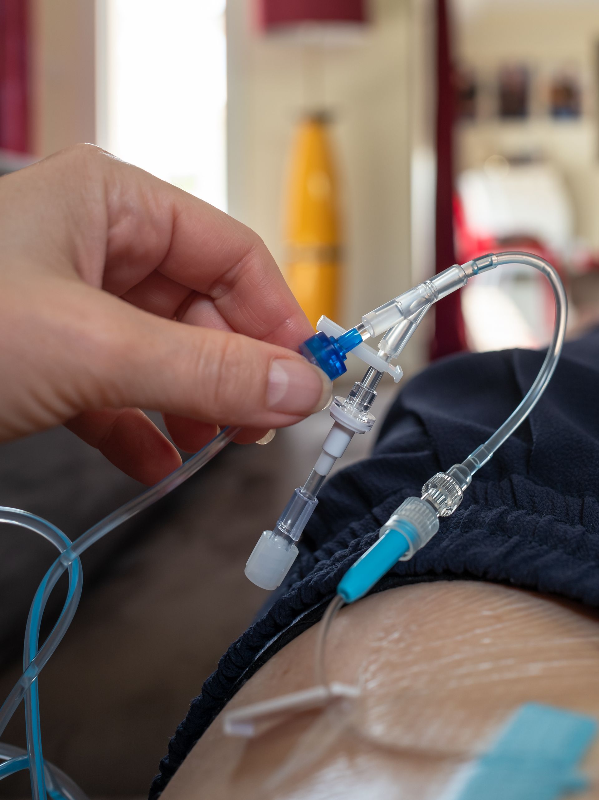 Réglage manuel d'une perfusion intraveineuse reliée au bras d'une personne ; tubes bleus et transparents.