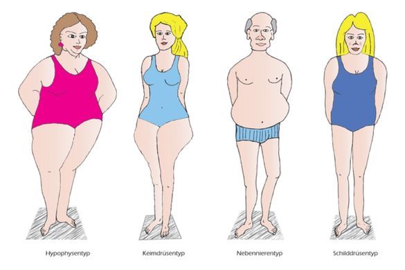 Illustration von verschiedenen Körperformen
