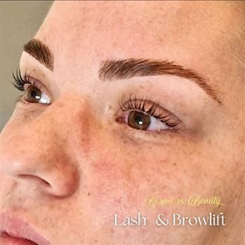 Browlifting Hürth Browlifting Hürth