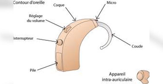 description d'un contour d'oreille