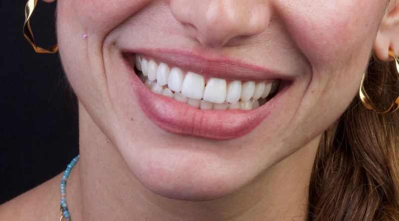 Primer plano de una boca sonriente con dientes blancos y lápiz labial rosa, luciendo pendientes de aro dorados.