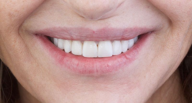 Primer plano de una boca sonriente con dientes blancos brillantes y labios rosados.