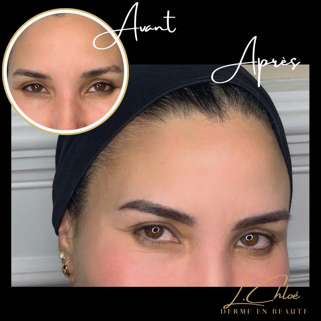 Maquillage permanent des sourcils