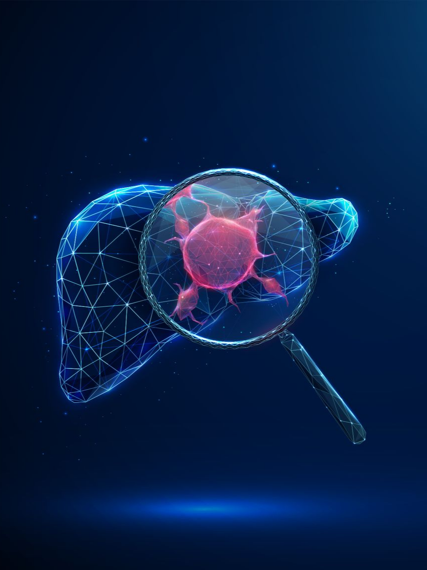 Image d'un foie et d'une tumeur à la loupe