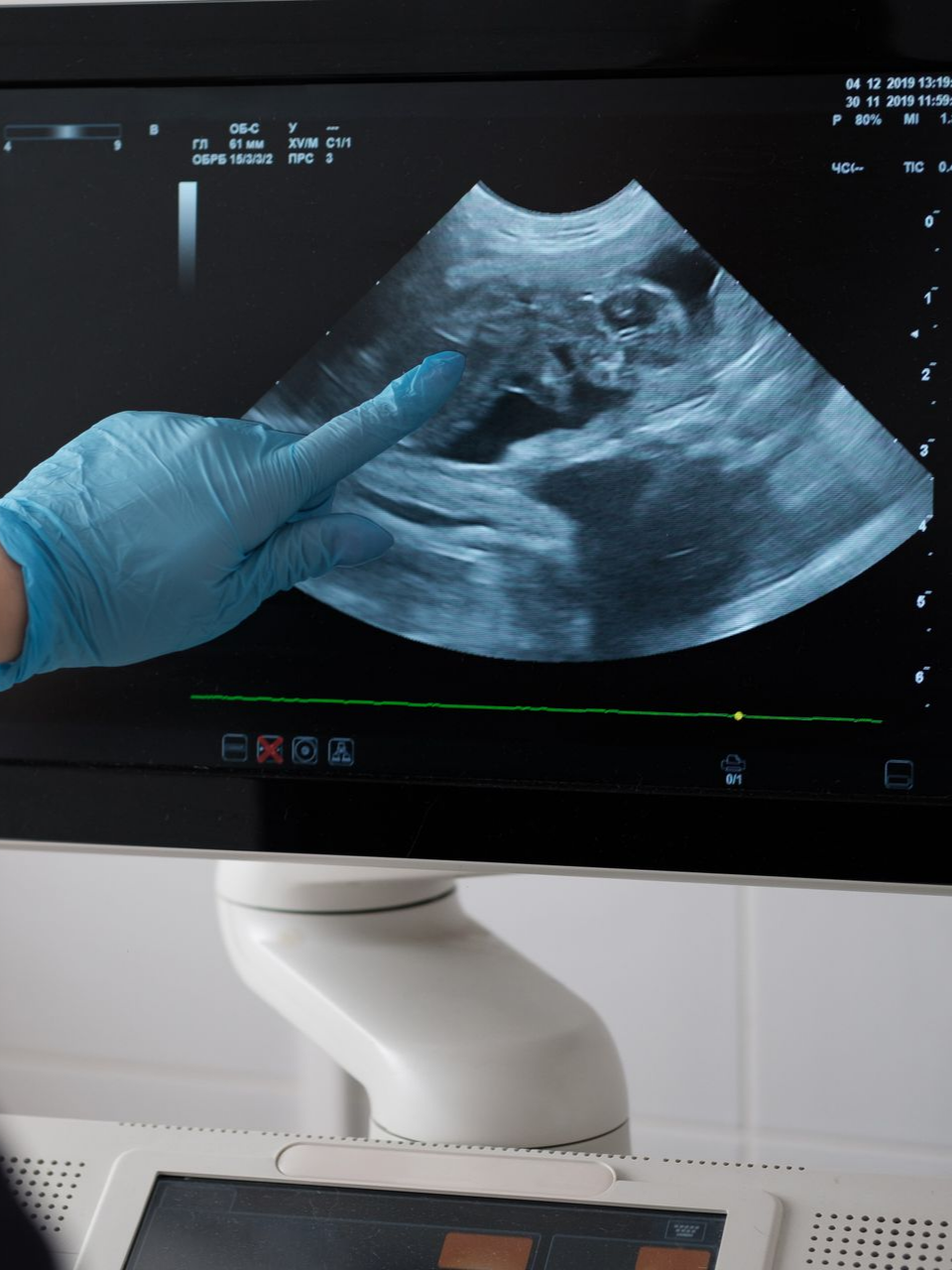 Médecin pointant le fœtus sur une échographie