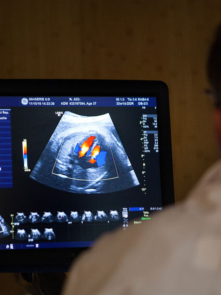 Médecin de dos regardant une échographie cardiaque