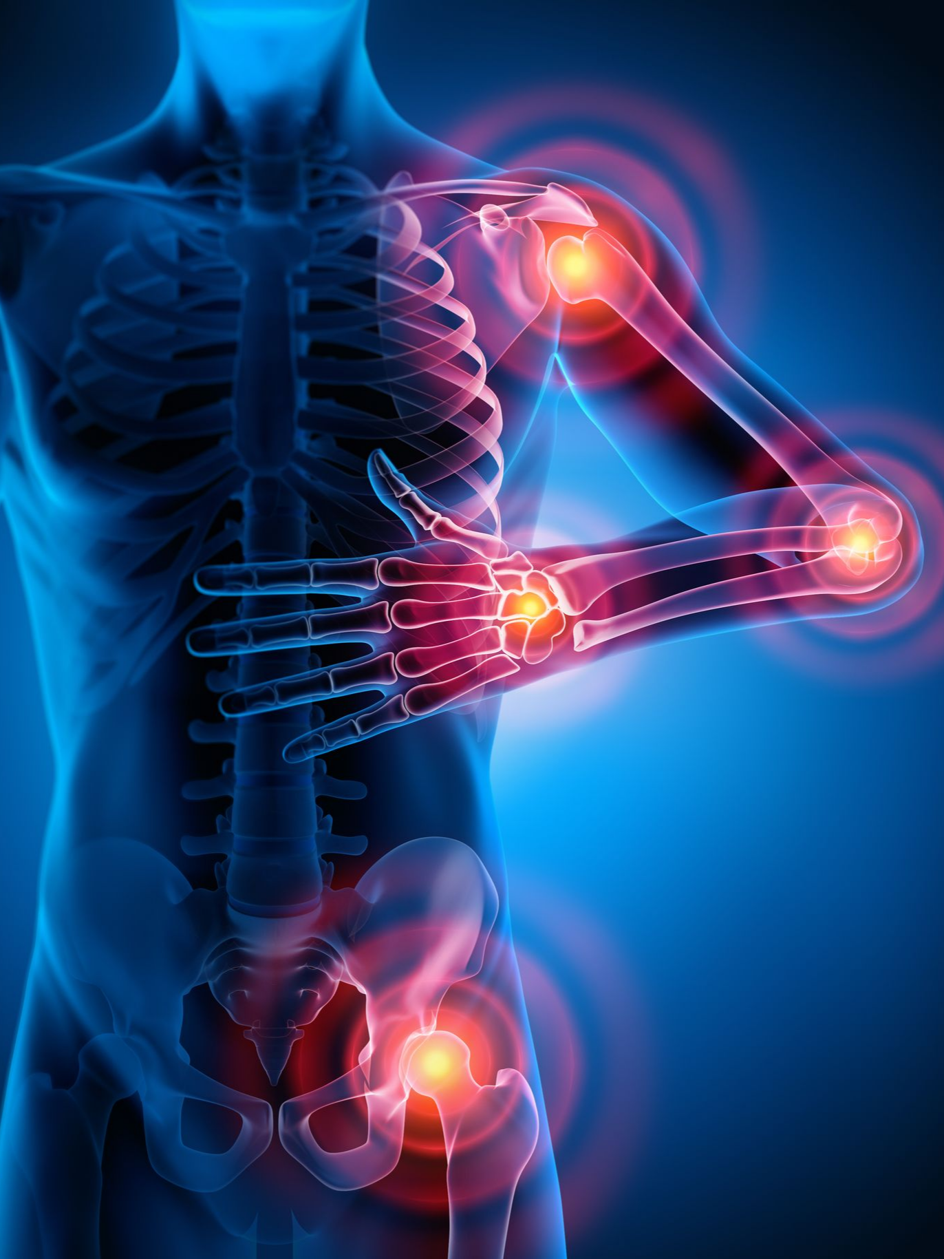 Articulations douloureuses sur un squelette vu aux rayons X